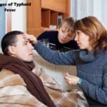 4 Stages of Typhoid Fever