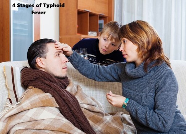 4 Stages of Typhoid Fever